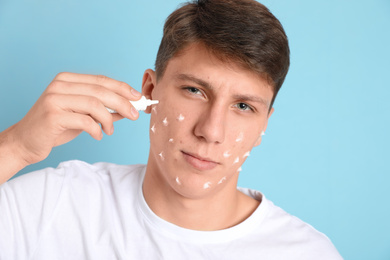 Teen guy with acne problem applying cream on light blue background