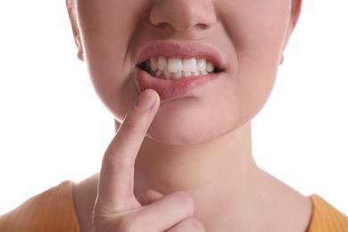 Woman showing gums on white background, closeup view