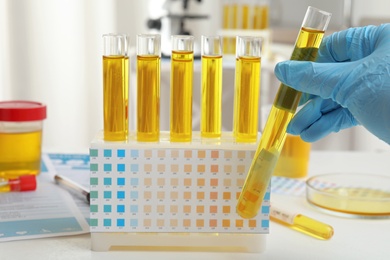 Doctor holding test tube with urine sample for analysis in laboratory, closeup