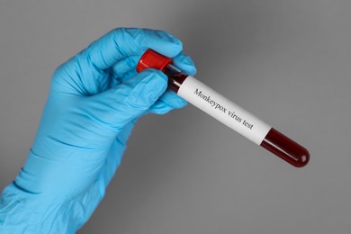 Photo of Monkeypox virus diagnosis. Laboratory worker holding test tube with blood sample on grey background, closeup