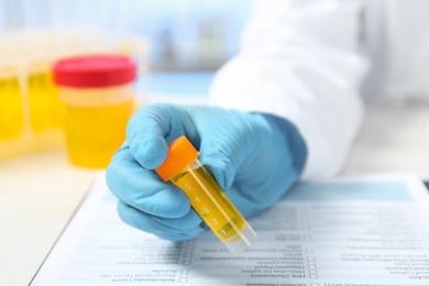 Laboratory assistant holding container with urine sample for analysis at table, closeup