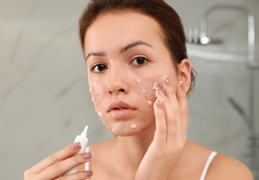 Teen girl with acne problem applying cream in bathroom
