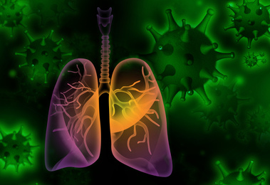 Illustration of diseased human lungs and viruses on dark background
