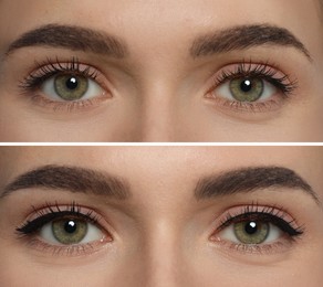Collage with photos of young woman before and after getting permanent eyeliner makeup, closeup