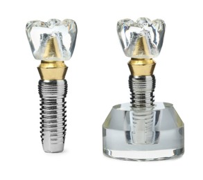 Educational models of dental implants on white background, collage