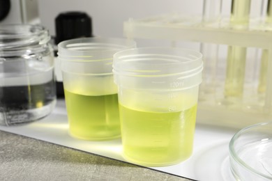 Containers with urine samples for analysis and glassware on grey table, closeup
