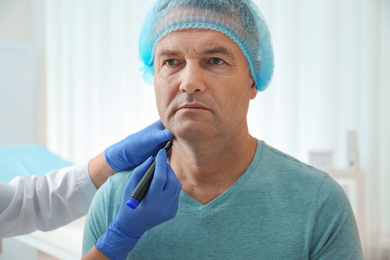 Photo of Surgeon with marker preparing man for operation in clinic. Double chin removal