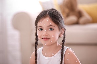Adorable little girl with chickenpox at home