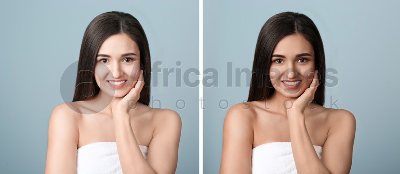 Collage with photos of beautiful young woman before and after indoor tanning on light grey background. Banner design