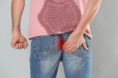 Man suffering from hemorrhoid on light grey background, closeup. Unhealthy bowel illustration
