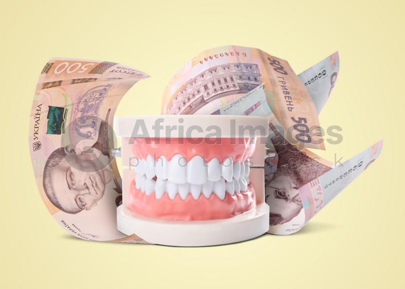 Model of oral cavity with teeth and hryvnia banknotes on beige background. Concept of expensive dental procedures