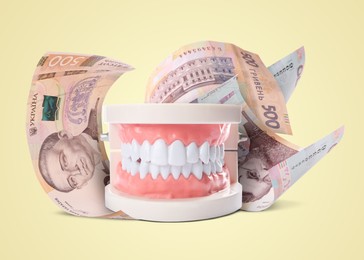 Model of oral cavity with teeth and hryvnia banknotes on beige background. Concept of expensive dental procedures