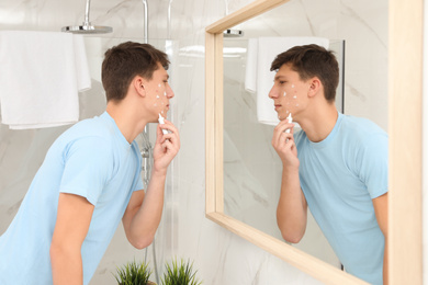 Teen guy with acne problem applying cream near mirror in bathroom