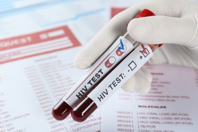 Scientist holding tubes with blood samples and labels HIV Test against laboratory forms, closeup