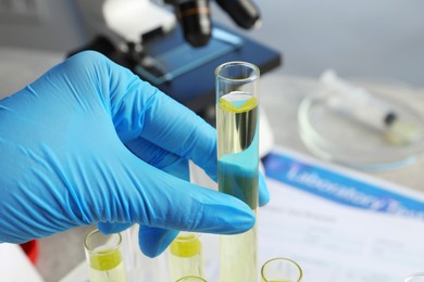 Doctor taking test tube with urine sample for analysis at table, closeup