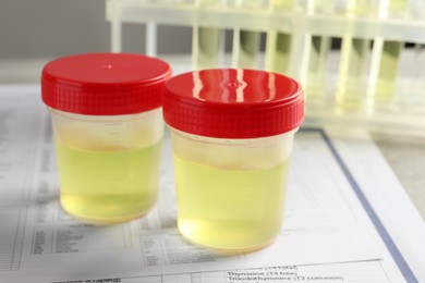Containers with urine sample for analysis and test form on table in laboratory, closeup
