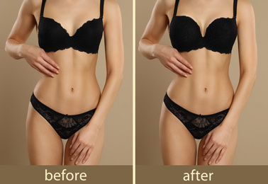 Woman before and after breast augmentation on beige background, closeup
