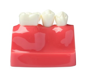 Educational model of gum with teeth on white background