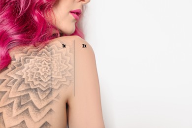 Woman before and after laser tattoo removal procedures on white background, closeup