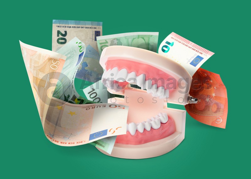 Model of oral cavity with teeth and euro banknotes on green background. Concept of expensive dental procedures