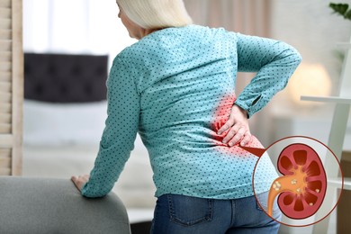 Mature woman suffering from pain because of kidney stones disease at home