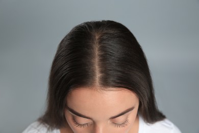 Woman with hair loss problem on grey background, above view. Trichology treatment