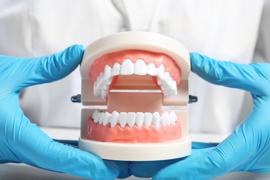 Dentist holding educational model of oral cavity with teeth at workplace, closeup