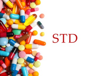 Different pills and abbreviation STD on white background, top view