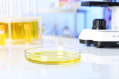 Petri dish with urine sample for analysis on table in laboratory