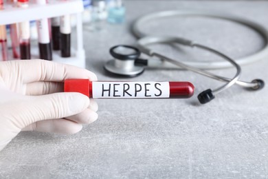 Doctor in glove holding test tube with word Herpes at grey table, closeup