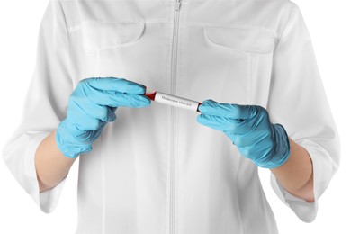 Photo of Monkeypox virus diagnosis. Laboratory worker holding test tube with blood sample on white background, closeup