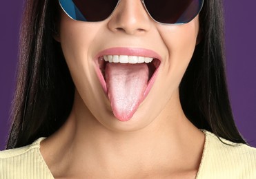 Young woman showing tongue with white patches on violet background, closeup. Oral candidiasis (thrush) disease