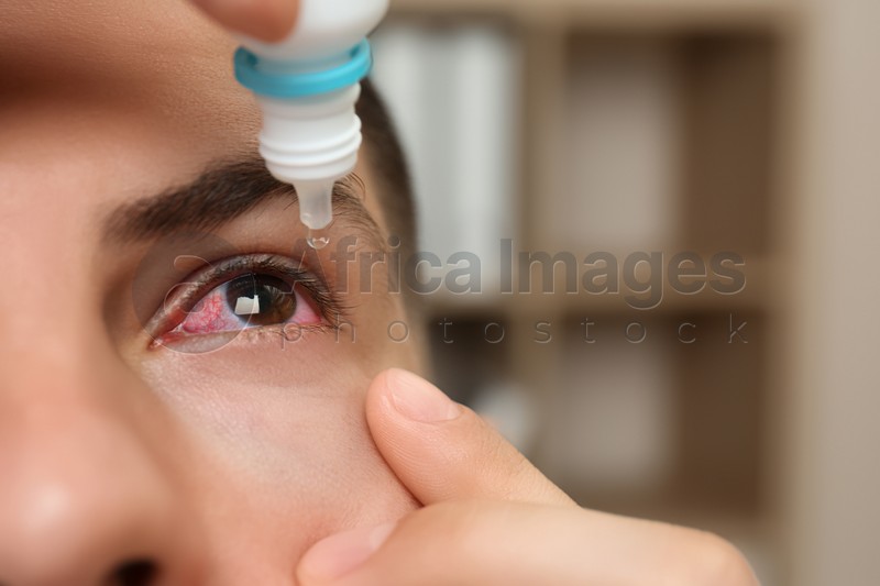 Man using eye drops on blurred background, closeup