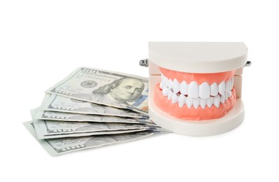 Educational dental typodont model and dollar banknotes on white background. Expensive treatment