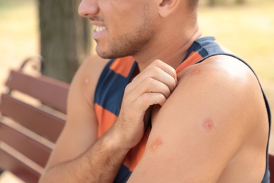 Man scratching arm with insect bites on bench outdoors, closeup