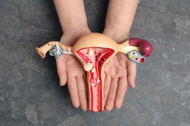 Woman with anatomical model of uterus at grey table, top view. Gynecology concept