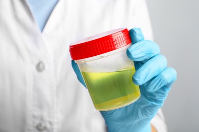 Doctor holding container with urine sample for analysis on grey background, closeup