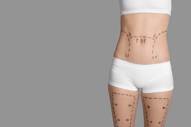 Young woman with marks on belly and legs for cosmetic surgery operation against color background