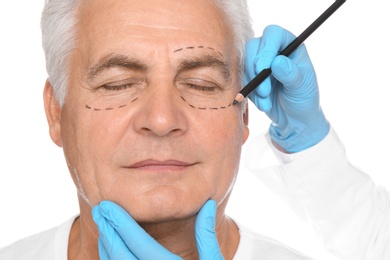 Doctor marking senior man face before cosmetic surgery on white background