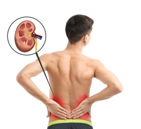 Man suffering from pain because of kidney stones disease on white background