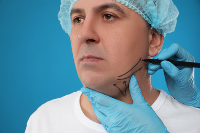 Surgeon with marker preparing man for operation on blue background. Double chin removal