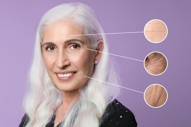 Image of Beautiful mature woman on violet background. Zoomed skin areas showing wrinkles before rejuvenation procedures