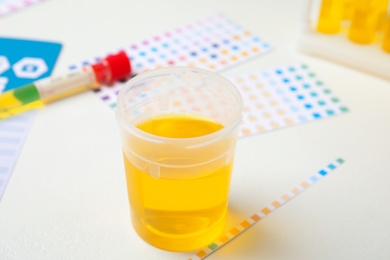Container with urine sample for analysis on white table