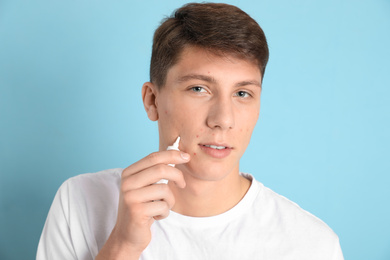 Photo of Teen guy with acne problem applying cream on light blue background