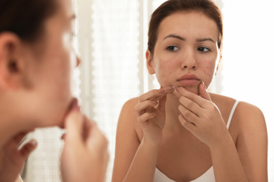 Teen girl with acne problem squeezing pimple near mirror in bathroom