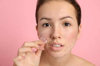 Photo of Teen girl applying acne healing patch on light pink background