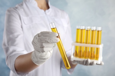 Doctor holding test tube with urine sample for analysis on light blue background, closeup