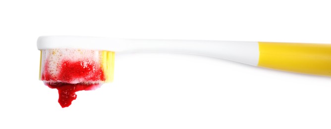 Photo of Toothbrush with paste and blood on white background, top view. Gum inflammation