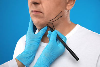 Surgeon with marker preparing man for operation on blue background. Double chin removal