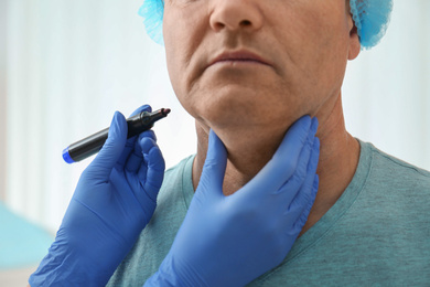 Photo of Surgeon with marker preparing man for operation in clinic, closeup. Double chin removal